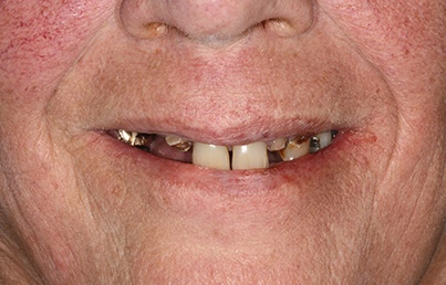 Smile gallary image - Before